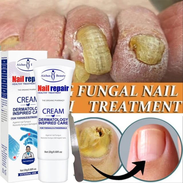 NAIL REPAIR 7™ - TRATAMIENTO ANTI HONGOS 7 DÍAS 100% NATURAL