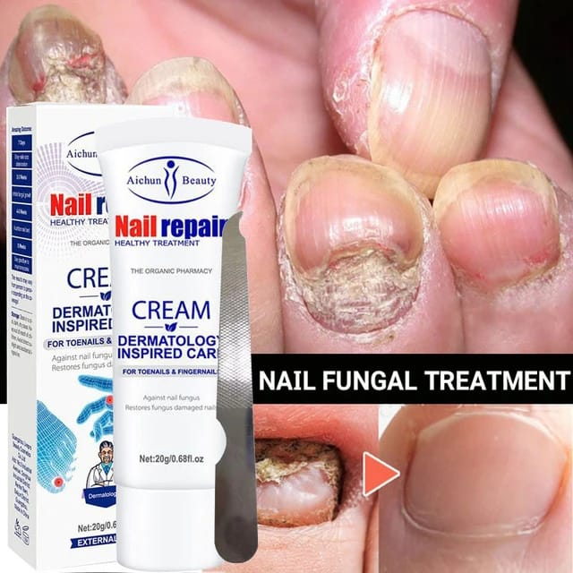 NAIL REPAIR 7™ - TRATAMIENTO ANTI HONGOS 7 DÍAS 100% NATURAL